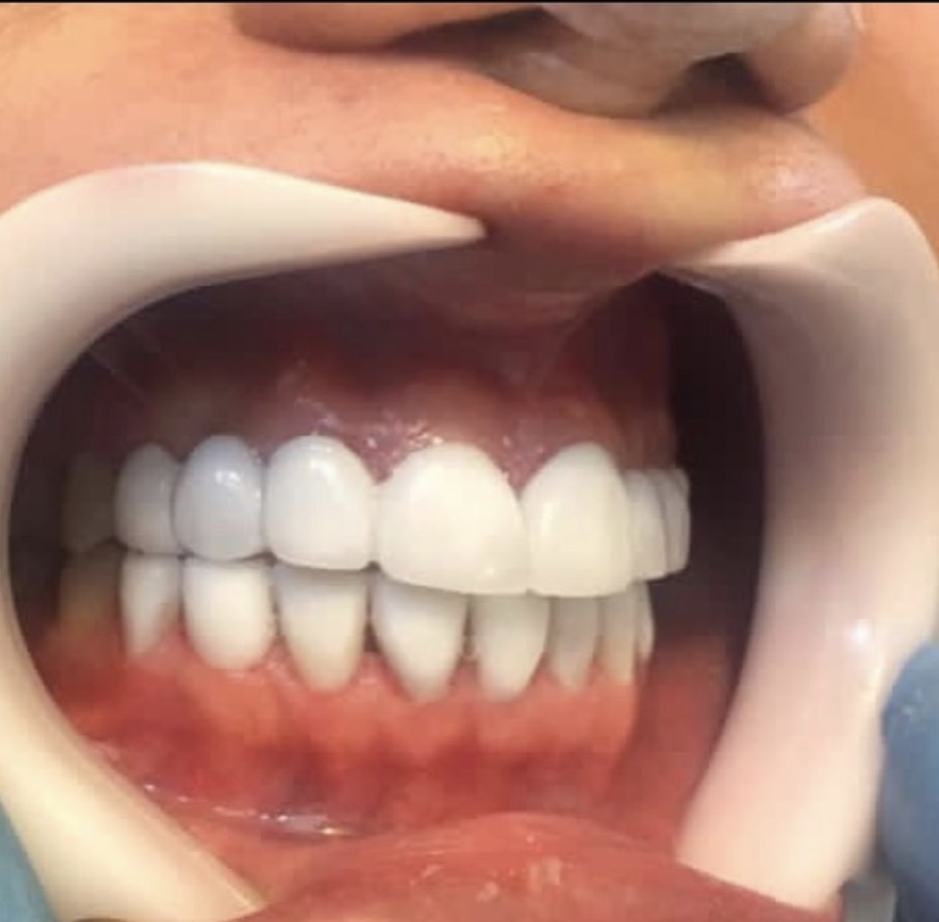 دکتر ملیحه طهرانی دندانپزشک یونیت
