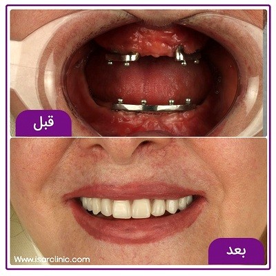 دکتر فاطمه ذوالفقاری دندانپزشک یونیت