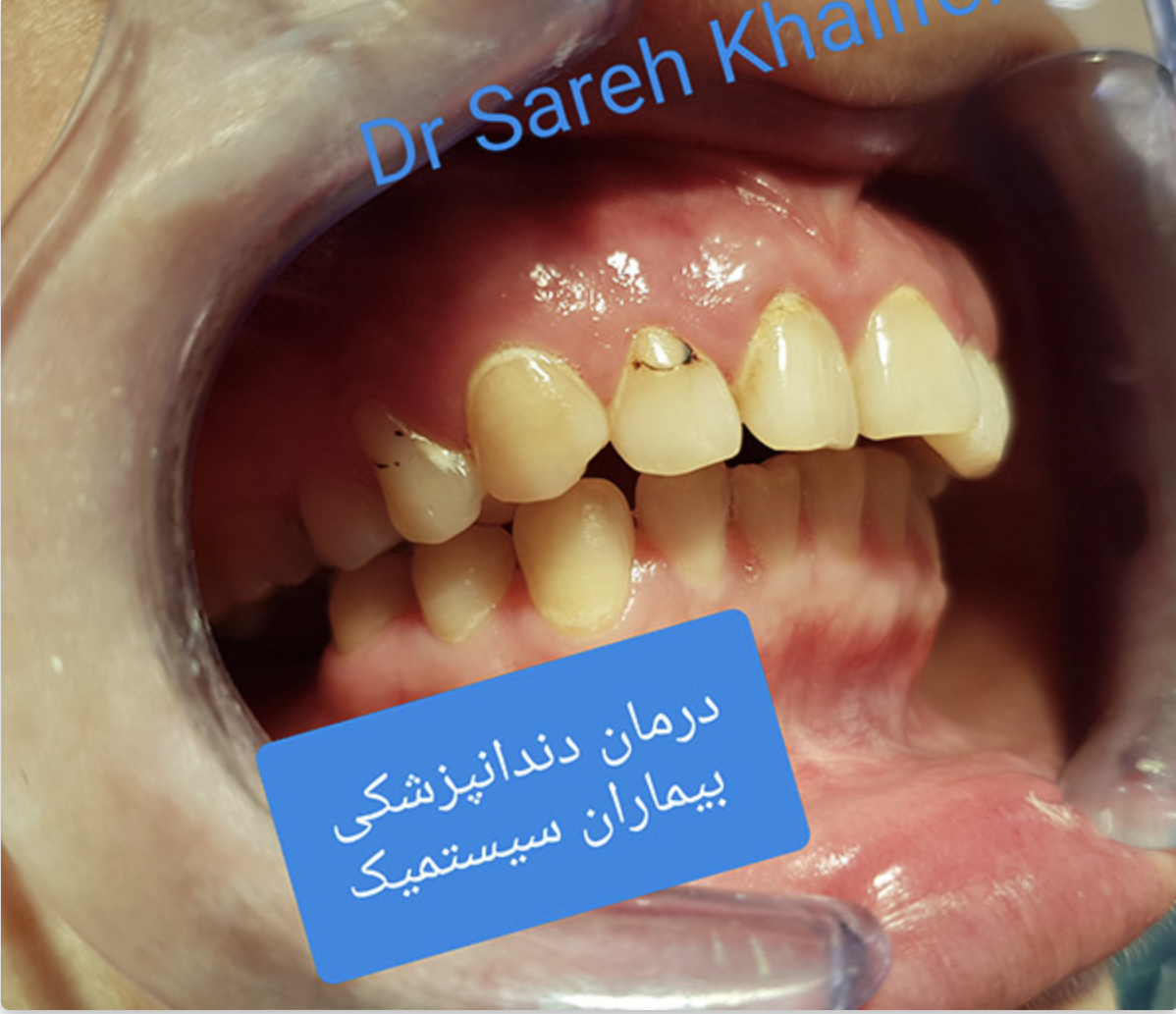 دکتر ساره خلیفه دندانپزشک یونیت